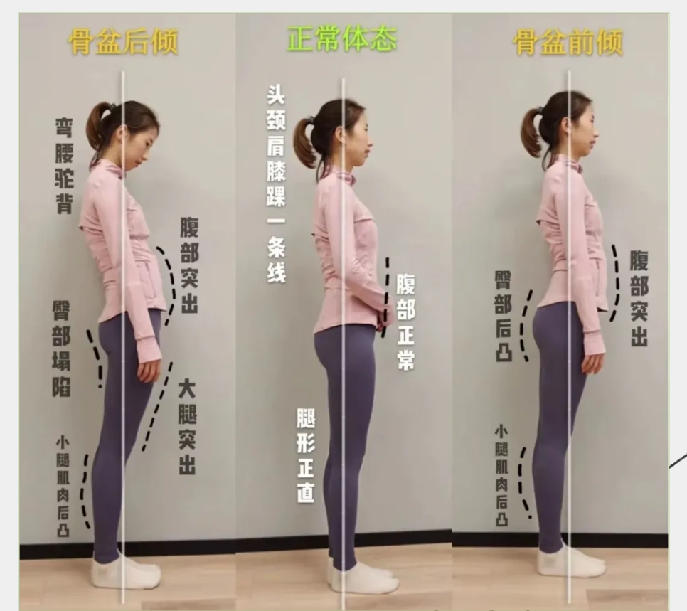 為(wèi)什(shén)麽越來(lái)越多(duō)的(de)女(nǚ)性，産後都(dōu)開(kāi)始做(zuò)骨盆修複？